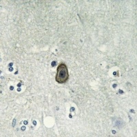 ROMK1 (phospho-S44) antibody