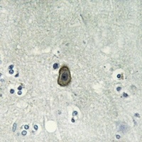 Anti-ROMK1 (Phospho-S44) Antibody