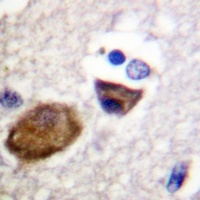 Anti-Kir5.1 (Phospho-S416) Antibody
