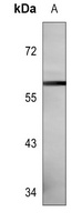 CD129 (Phospho-S519) Antibody