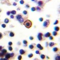 Anti-CD129 (Phospho-S519) Antibody