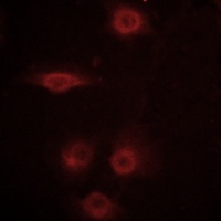 CD129 (phospho-S519) antibody