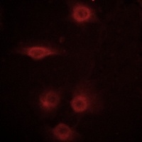 Anti-CD129 (Phospho-S519) Antibody