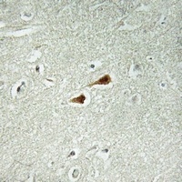 Anti-JIP1 (Phospho-T103) Antibody