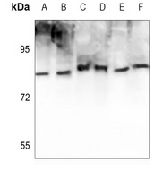 ATRIP (Phospho-S68) Antibody