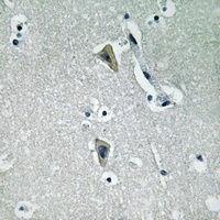 Anti-PKC theta (Phospho-T538) Antibody