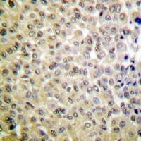 Anti-MSK1 (Phospho-S360) Antibody