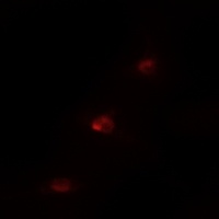 Anti-MSK1 (Phospho-S360) Antibody