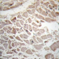 Anti-CD247 (Phospho-Y142) Antibody