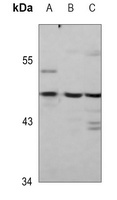 WIPI2 Rabbit Polyclonal Antibody