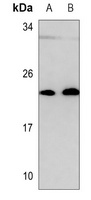 GPx-4 Rabbit Polyclonal Antibody