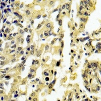 Anti-EPG5 Antibody