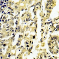 EPG5 antibody