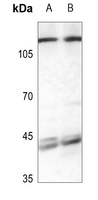 CLCN7 Antibody