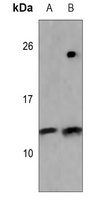 Histone H2B Rabbit Polyclonal Antibody