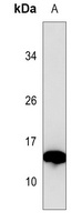 Histone H2B (Butyryl-K16) Rabbit Polyclonal Antibody