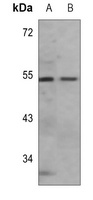 PTEN (Acetyl-K402) Rabbit Polyclonal Antibody