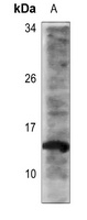 Histone H2B (Acetyl-K16) Rabbit Polyclonal Antibody