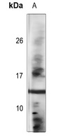 Histone H2B (Acetyl-K120) Antibody