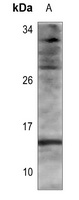 Histone H2B (Acetyl-K116) Antibody