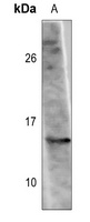 Histone H2A.Z (Acetyl-K11) Rabbit Polyclonal Antibody