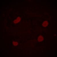 Histone H3 (AcK14) antibody