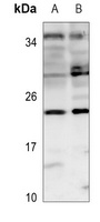 Claudin 6 Antibody