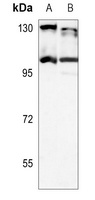 SERCA2 Antibody