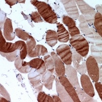 SERCA2 Antibody