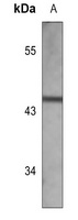 Haptoglobin Rabbit Polyclonal Antibody