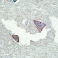 Anti-PDGFR alpha (Phospho-Y754) Antibody