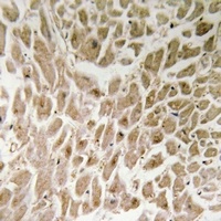 Anti-IRX1 Antibody