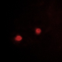 Anti-IRX1 Antibody
