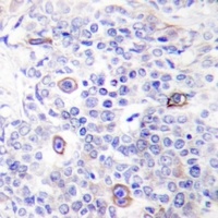 Anti-CD83 Antibody