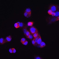 Anti-FGF23 Antibody