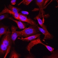 Anti-STAT6 Antibody