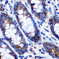 Anti-STAT4 Antibody