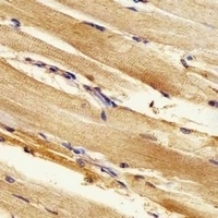 Anti-ak2 Antibody