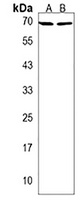 waca Rabbit Polyclonal Antibody