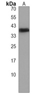 rho Rabbit Polyclonal Antibody