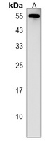 becn1 Rabbit Polyclonal Antibody