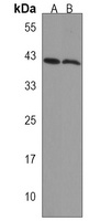 adra2db Rabbit Polyclonal Antibody