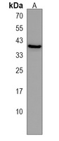 mab21l2 Antibody