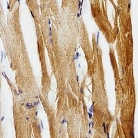 gfap Antibody