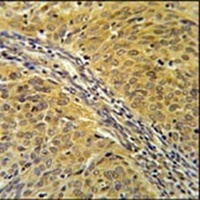 Anti-DYNC1LI2 Antibody