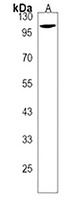 CCDC146 Rabbit Polyclonal Antibody