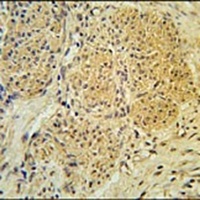 IPO7 Rabbit Polyclonal Antibody