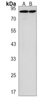 DEPDC1 Rabbit Polyclonal Antibody