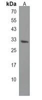 CRLS1 Antibody