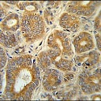 Anti-CRABP1 Antibody